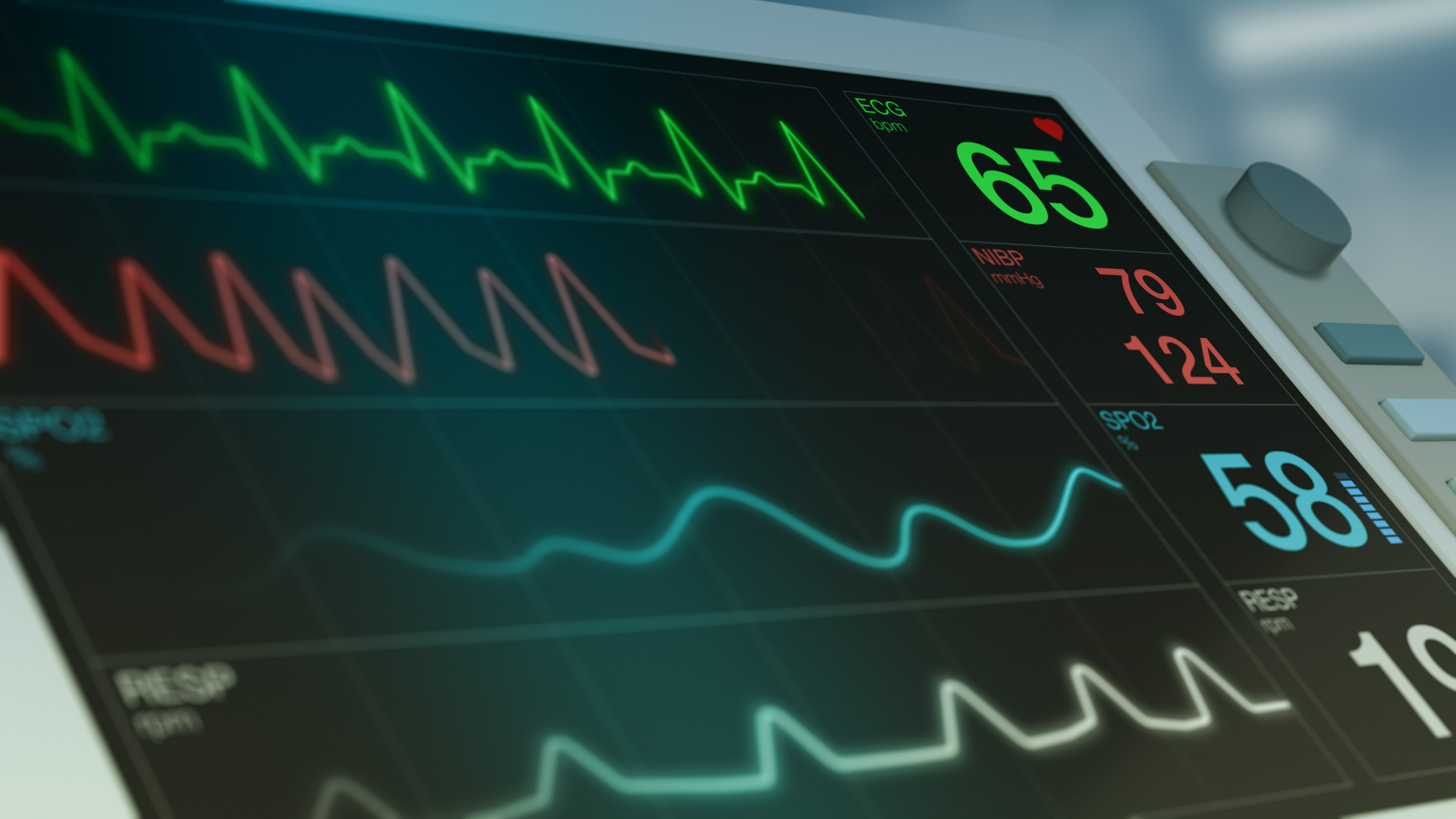 A cost-effective ECG monitoring in rural areas: leveraging artificial neural networks for efficient healthcare solutions image